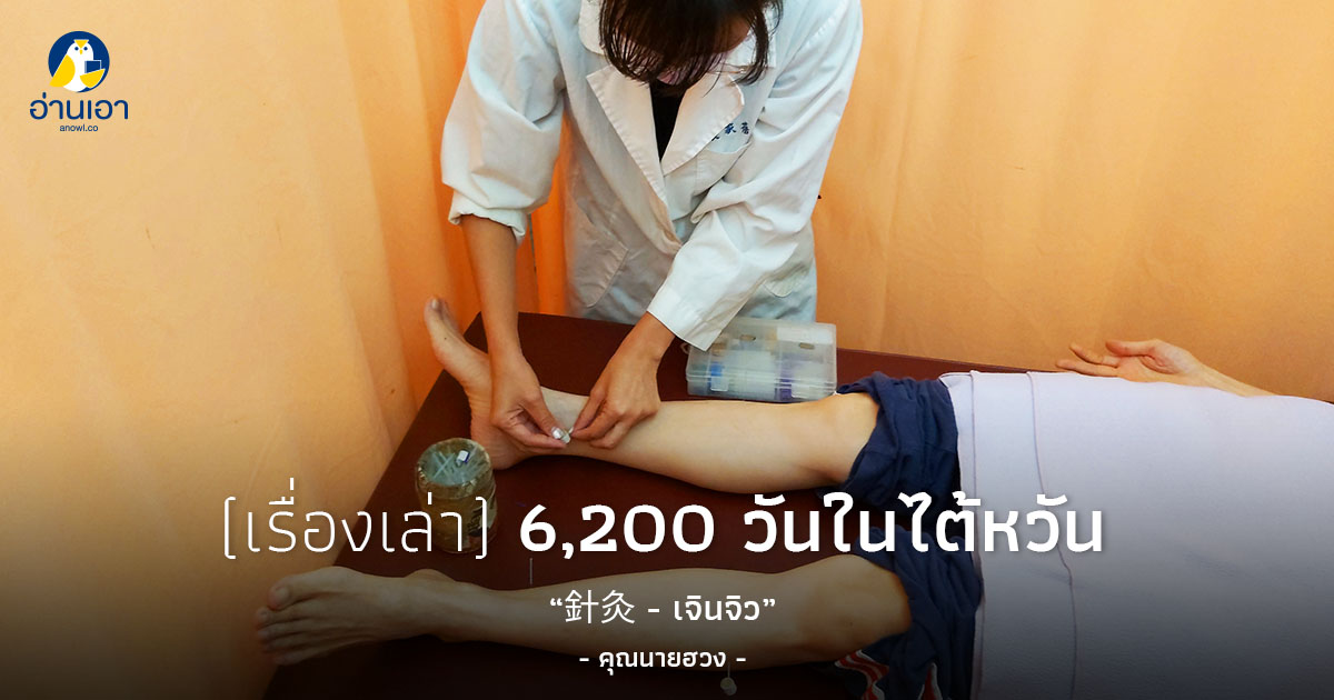 針灸 – เจินจิว